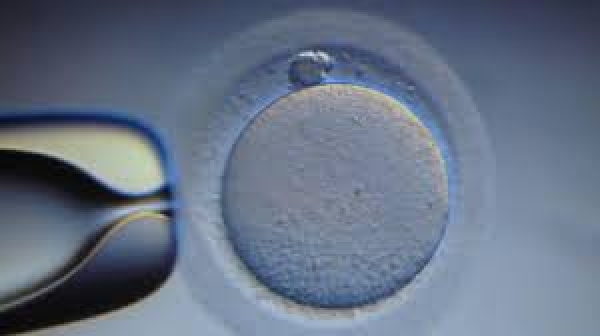 #PergunteResponderemos: 72 - O que a Igreja diz sobre inseminação artificial, doação de óvulos e gravidez assistida? Felipe Aquino